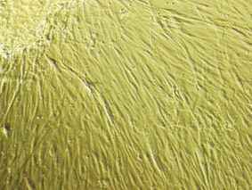 Help in injury and assist in repair Mesenchymal stem cells (MSCs) - Multi-potent Stem Cells