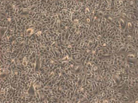 Key resource in epidermal and skin regeneration Epithelial stem cells (EpSCs) - Pluripotent Stem Cell